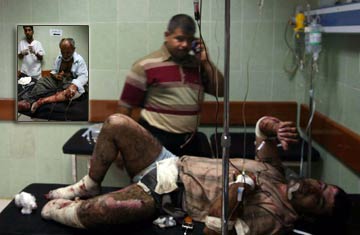 Det sikre Irak: Ofre for eksplosion i Kirkuk 7. august 2009