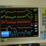Krisehjælp til det offentlige sundhedsvæsen – ikke til kapitalen!